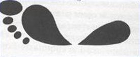 High Arch Pronation
