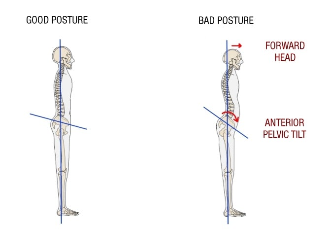 Good and bad posture