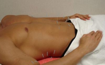 10 Ways Acupuncture Can Help With Fitness